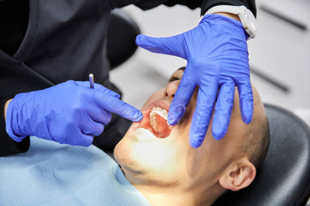Best Emergency Gum Treatment in Mansfield, LA